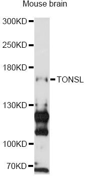 TONSL Antibody - Western blot analysis of extracts of mouse brain, using TONSL antibody at 1:3000 dilution. The secondary antibody used was an HRP Goat Anti-Rabbit IgG (H+L) at 1:10000 dilution. Lysates were loaded 25ug per lane and 3% nonfat dry milk in TBST was used for blocking. An ECL Kit was used for detection and the exposure time was 90s.