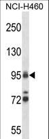 TOP1 / Topoisomerase I Antibody - TOP1 Antibody western blot of NCI-H460 cell line lysates (35 ug/lane). The TOP1 antibody detected the TOP1 protein (arrow).