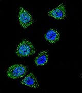 TOP1 / Topoisomerase I Antibody - Confocal immunofluorescence of TOP1 Antibody with HeLa cell followed by Alexa Fluor 488-conjugated goat anti-rabbit lgG (green). DAPI was used to stain the cell nuclear (blue).