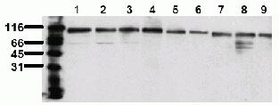 TOP1 / Topoisomerase I Antibody - WB using Topoisomerase I Antibody (23B11)