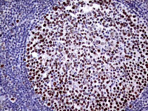 TOP1 / Topoisomerase I Antibody - Immunohistochemical staining of paraffin-embedded Human lymph node tissue within the normal limits using anti-TOP1 mouse monoclonal antibody. (Heat-induced epitope retrieval by 1mM EDTA in 10mM Tris buffer. (pH8.5) at 120°C for 3 min. (1:500)