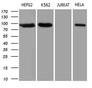 TOP1 / Topoisomerase I Antibody - Western blot analysis of extracts. (35ug) from 4 different cell lines by using anti-TOP1 monoclonal antibody. (1:500)