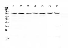 TOP1 / Topoisomerase I Antibody - Western blot - Anti-Topoisomerase I antibody
