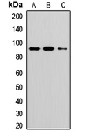TOP1 / Topoisomerase I Antibody - Western blot with Jurkat cell, HeLa cell, and mouse spleen extracts.