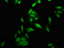 TOP1 / Topoisomerase I Antibody - Immunofluorescence staining of Hela cells at a dilution of 1:133, counter-stained with DAPI. The cells were fixed in 4% formaldehyde, permeabilized using 0.2% Triton X-100 and blocked in 10% normal Goat Serum. The cells were then incubated with the antibody overnight at 4 °C.The secondary antibody was Alexa Fluor 488-congugated AffiniPure Goat Anti-Rabbit IgG (H+L) .