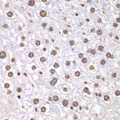 TOP1 / Topoisomerase I Antibody - Immunohistochemistry of paraffin-embedded mouse liver using TOP1 antibody at dilution of 1:100 (40x lens).