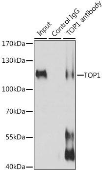 TOP1 / Topoisomerase I Antibody - Immunoprecipitation analysis of 200ug extracts of Jurkat cells, using 3 ug TOP1 antibody. Western blot was performed from the immunoprecipitate using TOP1 antibody at a dilition of 1:1000.