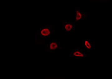TOP1 / Topoisomerase I Antibody - Staining HeLa cells by IF/ICC. The samples were fixed with PFA and permeabilized in 0.1% Triton X-100, then blocked in 10% serum for 45 min at 25°C. The primary antibody was diluted at 1:200 and incubated with the sample for 1 hour at 37°C. An Alexa Fluor 594 conjugated goat anti-rabbit IgG (H+L) Ab, diluted at 1/600, was used as the secondary antibody.