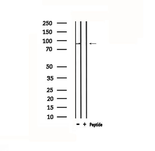 TOP1 / Topoisomerase I Antibody - Western blot analysis of extracts of mouse heart tissue using TOP1 antibody.