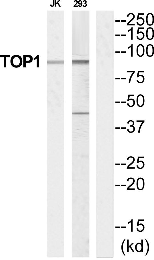 TOP1 / Topoisomerase I Antibody - Western blot analysis of extracts from Jurkat/293 cells, using TOP1 antibody.