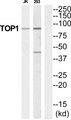 TOP1 / Topoisomerase I Antibody - Western blot analysis of extracts from Jurkat/293 cells, using TOP1 antibody.