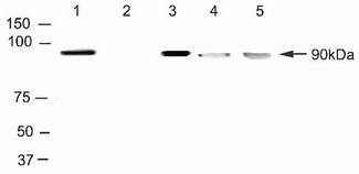 TOP1 / Topoisomerase I Antibody - IP using Topoisomerase I Antibody (24.5)