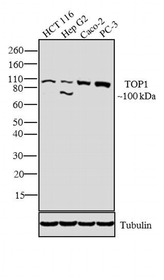 TOP1 / Topoisomerase I Antibody - TOP1 Antibody in Western Blot (WB)