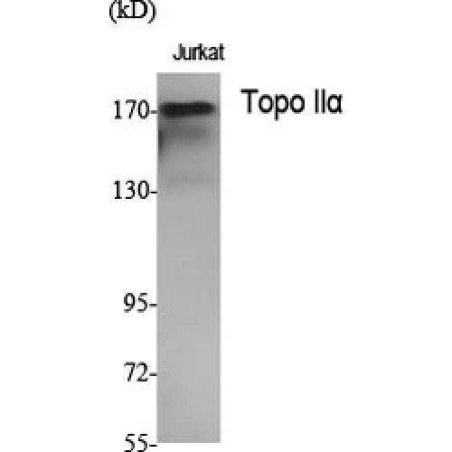 TOP2A / Topoisomerase II Alpha Antibody - Western blot of Topo IIalpha antibody