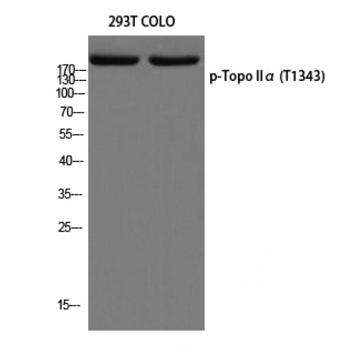 TOP2A / Topoisomerase II Alpha Antibody - Western blot of Phospho-Topo IIalpha (T1343) antibody