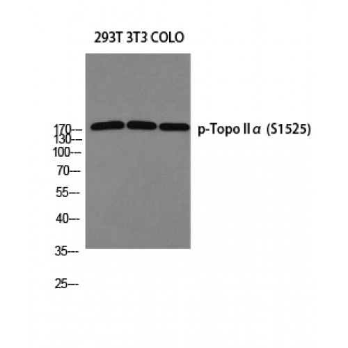 TOP2A / Topoisomerase II Alpha Antibody - Western blot of Phospho-Topo IIalpha (S1525) antibody