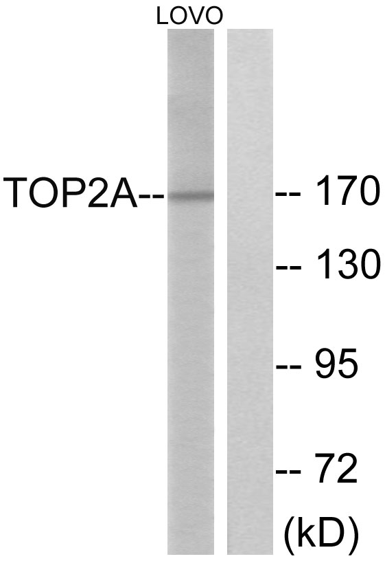 TOP2A / Topoisomerase II Alpha Antibody - Western blot analysis of lysates from LOVO cells, using TOP2A Antibody. The lane on the right is blocked with the synthesized peptide.