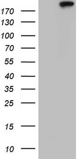 TOP2A / Topoisomerase II Alpha Antibody - HEK293T cells were transfected with the pCMV6-ENTRY control (Left lane) or pCMV6-ENTRY TOP2A (Right lane) cDNA for 48 hrs and lysed. Equivalent amounts of cell lysates (5 ug per lane) were separated by SDS-PAGE and immunoblotted with anti-TOP2A.