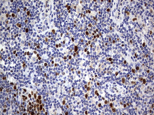 TOP2A / Topoisomerase II Alpha Antibody - IHC of paraffin-embedded Human lymph node tissue using anti-TOP2A mouse monoclonal antibody. (Heat-induced epitope retrieval by 1 mM EDTA in 10mM Tris, pH9.0, 120°C for 3min).