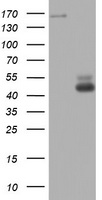 TOP2A / Topoisomerase II Alpha Antibody - HEK293T cells were transfected with the pCMV6-ENTRY control (Left lane) or pCMV6-ENTRY TOP2A (Right lane) cDNA for 48 hrs and lysed. Equivalent amounts of cell lysates (5 ug per lane) were separated by SDS-PAGE and immunoblotted with anti-TOP2A.