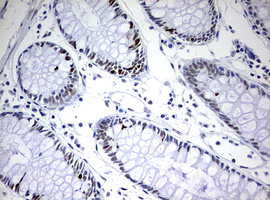 TOP2A / Topoisomerase II Alpha Antibody - IHC of paraffin-embedded Human colon tissue using anti-TOP2A mouse monoclonal antibody. (Heat-induced epitope retrieval by 10mM citric buffer, pH6.0, 120°C for 3min).