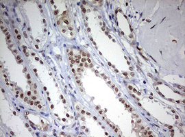 TOP2A / Topoisomerase II Alpha Antibody - IHC of paraffin-embedded Human Kidney tissue using anti-TOP2A mouse monoclonal antibody. (Heat-induced epitope retrieval by 10mM citric buffer, pH6.0, 120°C for 3min).