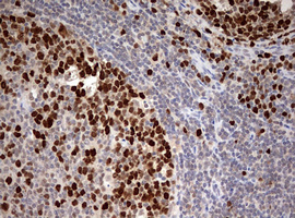 TOP2A / Topoisomerase II Alpha Antibody - IHC of paraffin-embedded Human lymph node tissue using anti-TOP2A mouse monoclonal antibody. (Heat-induced epitope retrieval by 10mM citric buffer, pH6.0, 120°C for 3min).