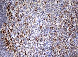 TOP2A / Topoisomerase II Alpha Antibody - IHC of paraffin-embedded Human tonsil using anti-TOP2A mouse monoclonal antibody. (Heat-induced epitope retrieval by 10mM citric buffer, pH6.0, 120°C for 3min).