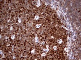 TOP2A / Topoisomerase II Alpha Antibody - IHC of paraffin-embedded Human lymph node tissue using anti-TOP2A mouse monoclonal antibody. (Heat-induced epitope retrieval by 1 mM EDTA in 10mM Tris, pH9.0, 120°C for 3min).