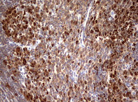 TOP2A / Topoisomerase II Alpha Antibody - IHC of paraffin-embedded Human tonsil using anti-TOP2A mouse monoclonal antibody. (Heat-induced epitope retrieval by 1 mM EDTA in 10mM Tris, pH9.0, 120°C for 3min).