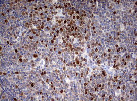 TOP2A / Topoisomerase II Alpha Antibody - IHC of paraffin-embedded Human lymph node tissue using anti-TOP2A mouse monoclonal antibody. (Heat-induced epitope retrieval by 10mM citric buffer, pH6.0, 120°C for 3min).