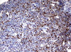 TOP2A / Topoisomerase II Alpha Antibody - IHC of paraffin-embedded Human tonsil using anti-TOP2A mouse monoclonal antibody. (Heat-induced epitope retrieval by 10mM citric buffer, pH6.0, 120°C for 3min).