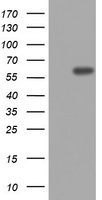 TOP2A / Topoisomerase II Alpha Antibody - HEK293T cells were transfected with the pCMV6-ENTRY control (Left lane) or pCMV6-ENTRY TOP2A (Right lane) cDNA for 48 hrs and lysed. Equivalent amounts of cell lysates (5 ug per lane) were separated by SDS-PAGE and immunoblotted with anti-TOP2A.