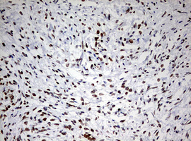 TOP2A / Topoisomerase II Alpha Antibody - IHC of paraffin-embedded Human Ovary tissue using anti-TOP2A mouse monoclonal antibody. (Heat-induced epitope retrieval by 10mM citric buffer, pH6.0, 120°C for 3min).