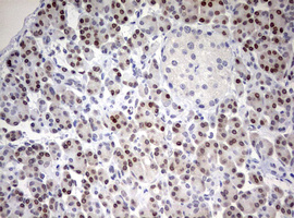 TOP2A / Topoisomerase II Alpha Antibody - IHC of paraffin-embedded Human pancreas tissue using anti-TOP2A mouse monoclonal antibody. (Heat-induced epitope retrieval by 10mM citric buffer, pH6.0, 120°C for 3min).