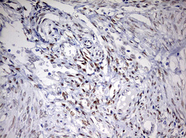 TOP2A / Topoisomerase II Alpha Antibody - IHC of paraffin-embedded Human endometrium tissue using anti-TOP2A mouse monoclonal antibody. (Heat-induced epitope retrieval by 10mM citric buffer, pH6.0, 120°C for 3min).