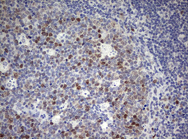 TOP2A / Topoisomerase II Alpha Antibody - IHC of paraffin-embedded Human lymph node tissue using anti-TOP2A mouse monoclonal antibody. (Heat-induced epitope retrieval by 10mM citric buffer, pH6.0, 120°C for 3min).