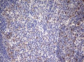 TOP2A / Topoisomerase II Alpha Antibody - IHC of paraffin-embedded Human tonsil using anti-TOP2A mouse monoclonal antibody. (Heat-induced epitope retrieval by 10mM citric buffer, pH6.0, 120°C for 3min).