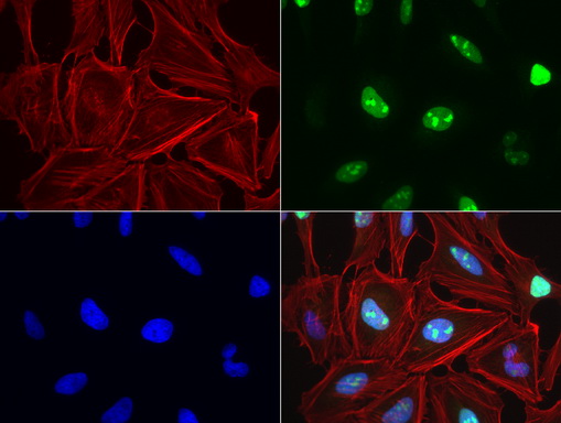 TOP2A / Topoisomerase II Alpha Antibody - Immunofluorescent staining of HeLa cells using anti-TOP2A mouse monoclonal antibody  green, 1:100). Actin filaments were labeled with Alexa Fluor® 594 Phalloidin. (red), and nuclear with DAPI. (blue).