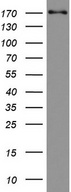 TOP2A / Topoisomerase II Alpha Antibody - Western blot analysis of Jurkat cell lysate. (35ug) by using anti-TOP2A monoclonal antibody.