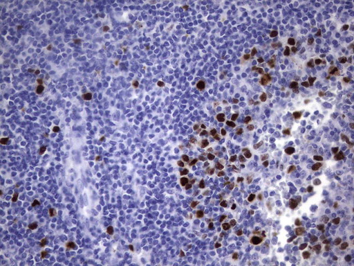 TOP2A / Topoisomerase II Alpha Antibody - Immunohistochemical staining of paraffin-embedded Human tonsil using anti-TOP2A mouse monoclonal antibody.  heat-induced epitope retrieval by 1 mM EDTA in 10mM Tris, pH8.0, 120C for 3min)