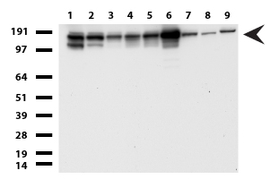 TOP2A / Topoisomerase II Alpha Antibody - Western blot of cell lysates. (35ug) from 9 different cell lines. (1: HepG2, 2: HeLa, 3: SV-T2, 4: A549. 5: COS7, 6: Jurkat, 7: PC-12, 8: MDCK, 9: MCF7).