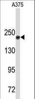 TOP2A / Topoisomerase II Alpha Antibody - Western blot of TOP2A Antibody in A375 cell line lysates (35 ug/lane). TOP2A (arrow) was detected using the purified antibody.