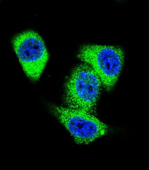 TOP2A / Topoisomerase II Alpha Antibody - Confocal immunofluorescence of TOP2A Antibody with HeLa cell followed by Alexa Fluor 488-conjugated goat anti-rabbit lgG (green). DAPI was used to stain the cell nuclear (blue).