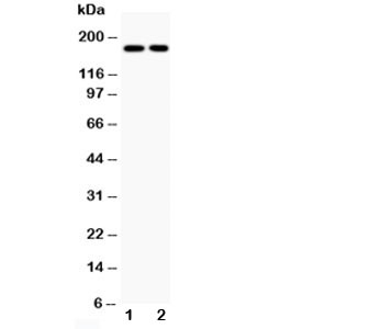 TOP2A / Topoisomerase II Alpha Antibody - Western blot testing of Topoisomerase II alpha antibody and Lane 1: HeLa; 2: Jurkat; Predicted size: 174KD; Observed size: 174KD