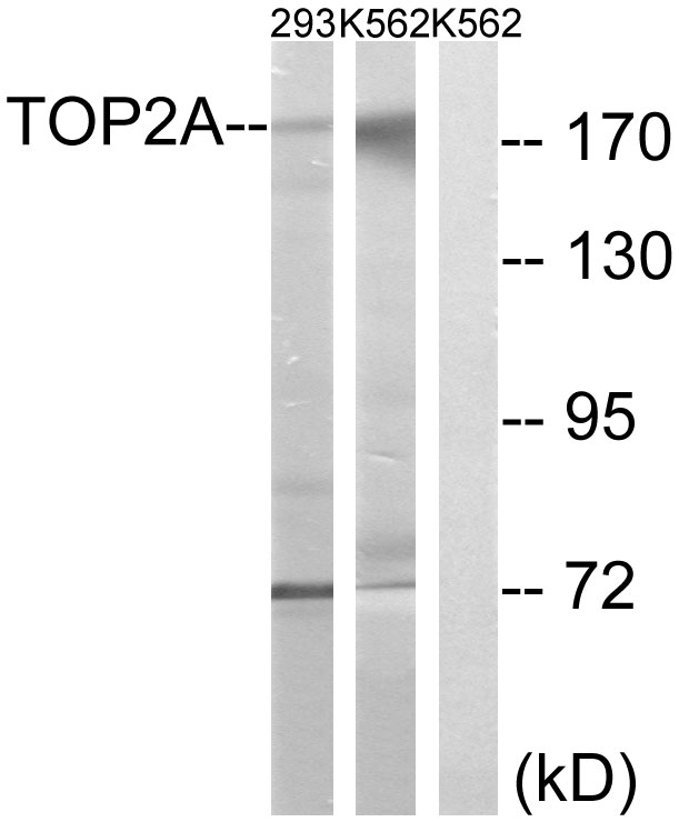 TOP2A / Topoisomerase II Alpha Antibody - Western blot analysis of lysates from K562 and 293 cells, using TOP2A Antibody. The lane on the right is blocked with the synthesized peptide.