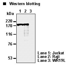 TOP2A / Topoisomerase II Alpha Antibody