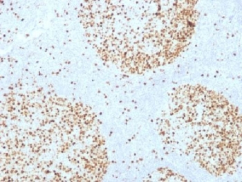 TOP2A / Topoisomerase II Alpha Antibody - IHC testing of FFPE human tonsil with Topoisomerase II alpha antibody (clone TOP2A/1361). Required HIER: boil sections in 10mM citrate buffer, pH6, for 10-20 min followed by cooling at RT for 20 min.