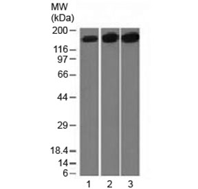 TOP2A / Topoisomerase II Alpha Antibody - Western blot testing of 1) human HepG2, 2) HeLa and 3) mouse NIH3T3 cell lysate with Topoisomerase II alpha antibody (clone TOP2A/1361). Expected molecular weight ~174 kDa.