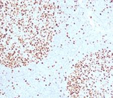 TOP2A / Topoisomerase II Alpha Antibody -  This image was taken for the unmodified form of this product. Other forms have not been tested.